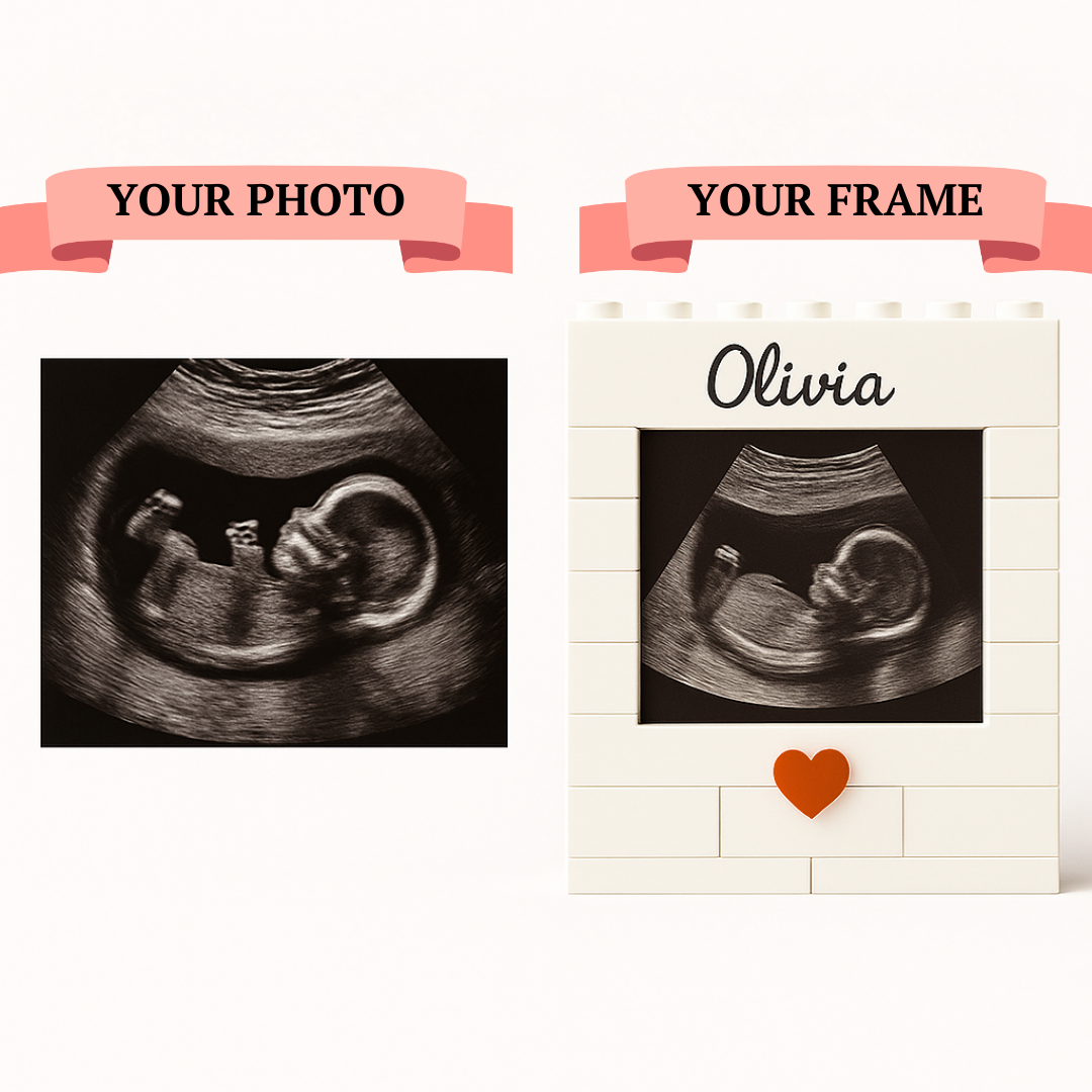 Personalized Ultrasound Brick Set