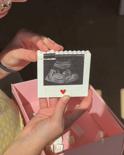 Personalized Ultrasound Brick Set